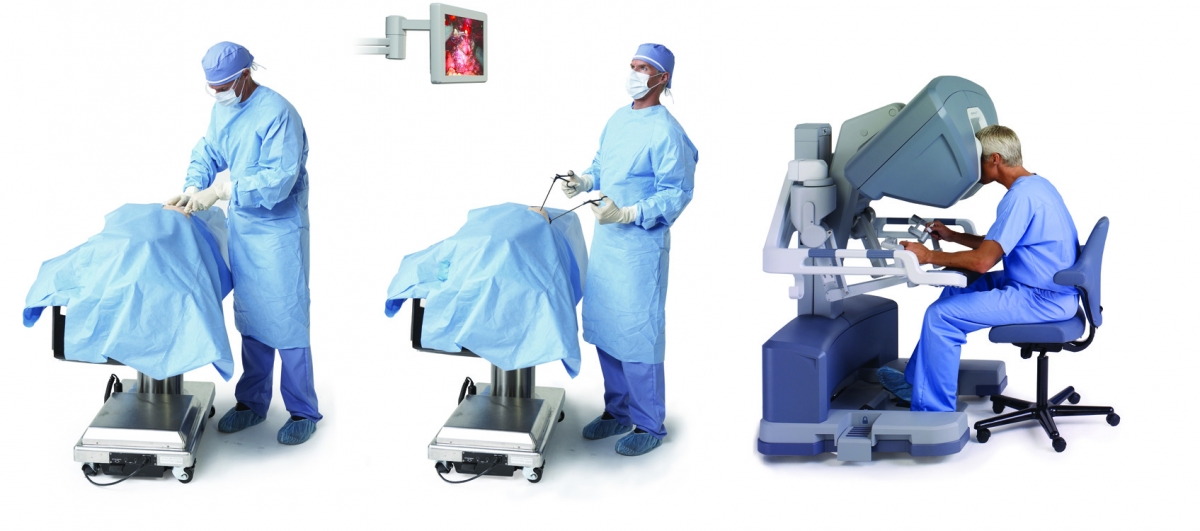 Что лучше роботическая или лапароскопическая операция?